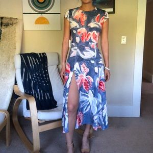 NWT ARITZIA BABATON Midi Dress